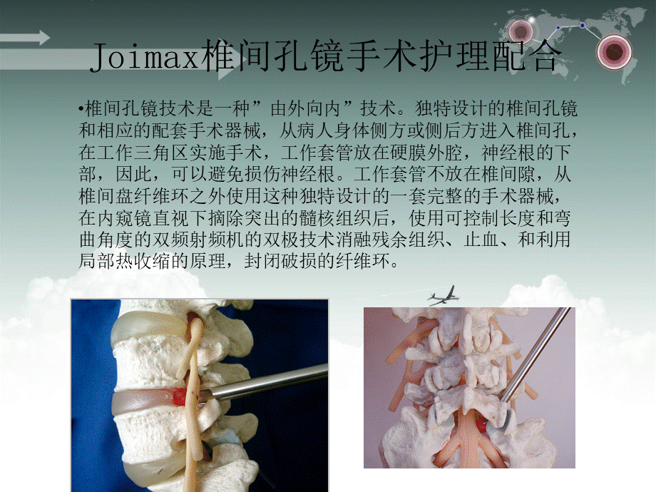 椎间孔镜手术护理配合ppt课件优质PPT.ppt_第2页