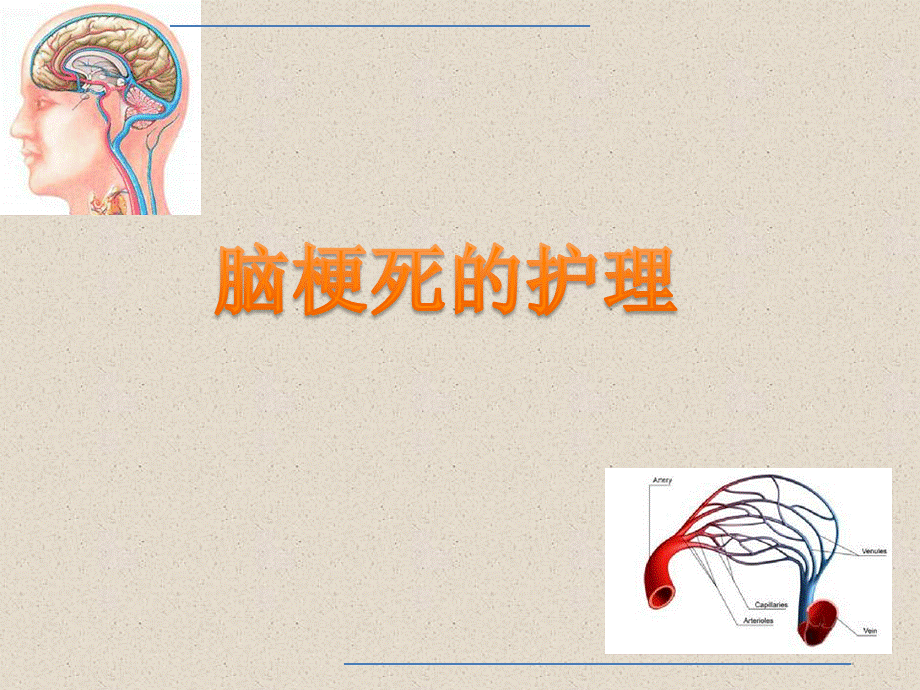 脑梗死的护理PPT课件.ppt