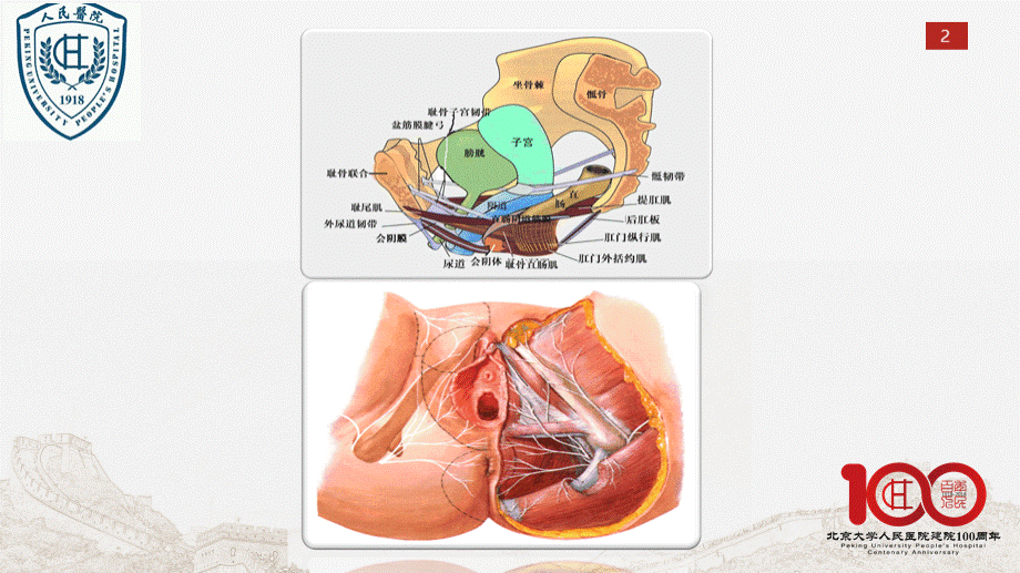 盆底康复.pptx_第2页