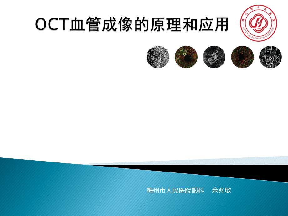 OCT血管成像的原理和应用PPT推荐.pptx