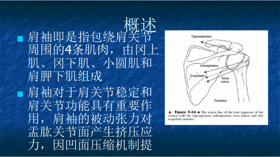 肩袖损伤的康复医学ppt.pptx_第3页