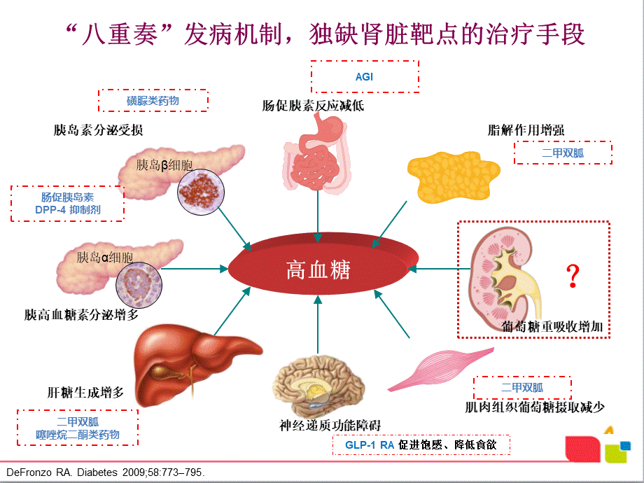 达格列净-肾脏在-型糖尿病血糖调控中的作用.ppt_第3页