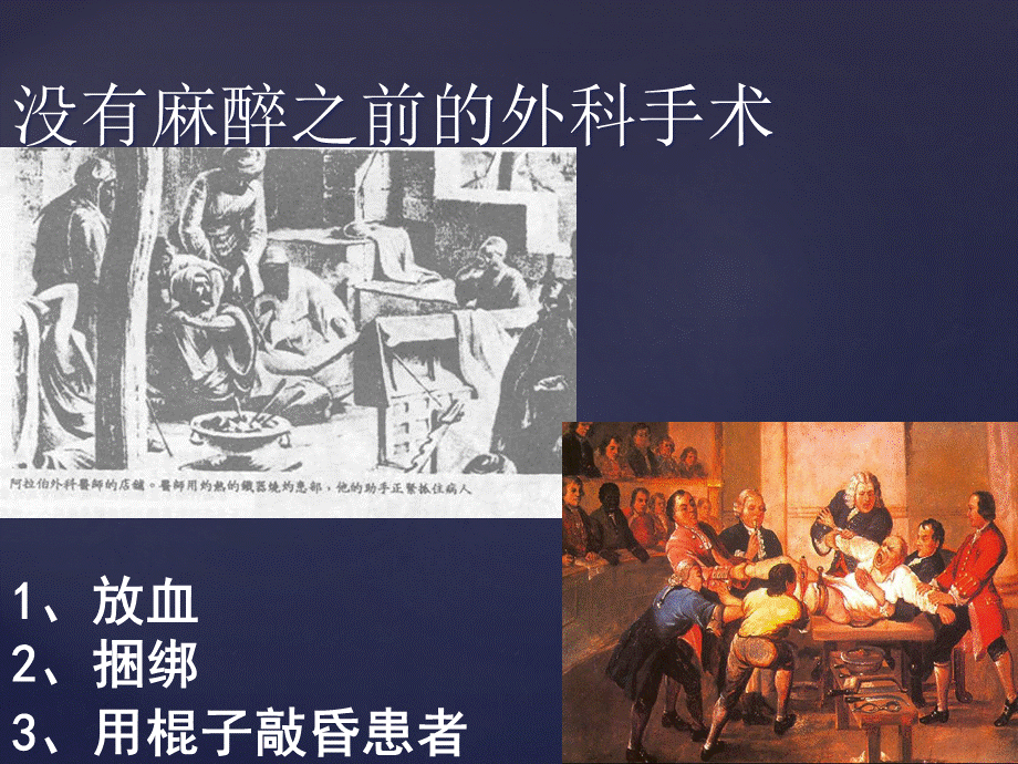 中国麻醉学科发展历史回顾PPT推荐.ppt_第3页