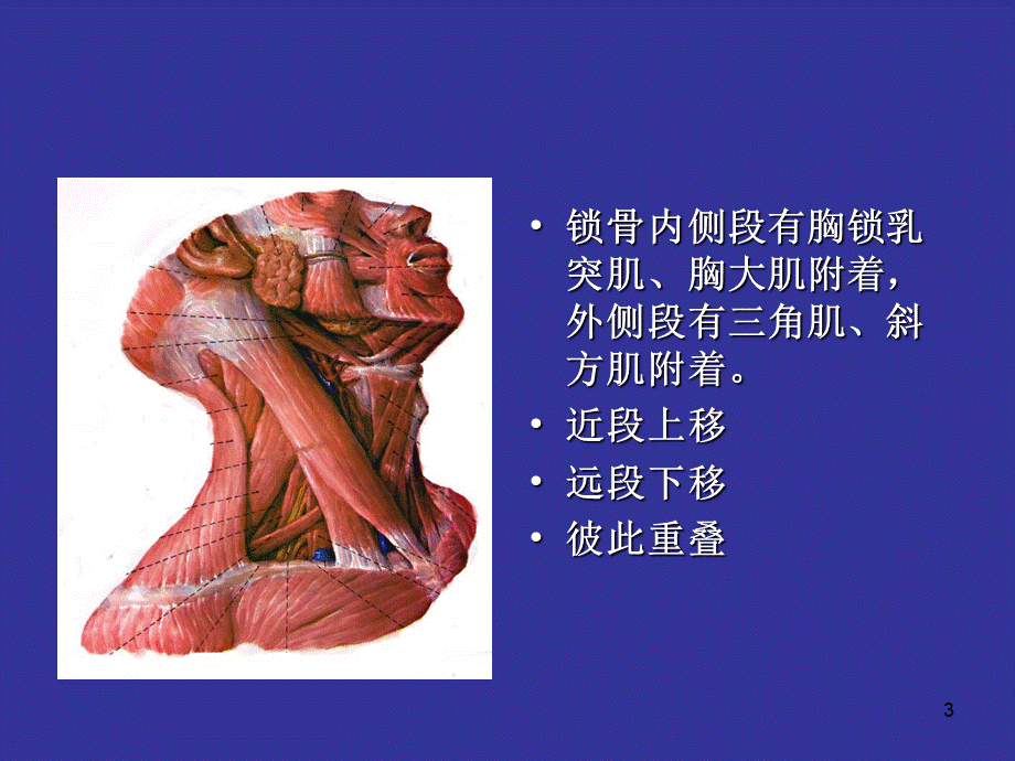 锁骨骨折诊断及治疗幻灯片课件PPT文档格式.ppt_第3页