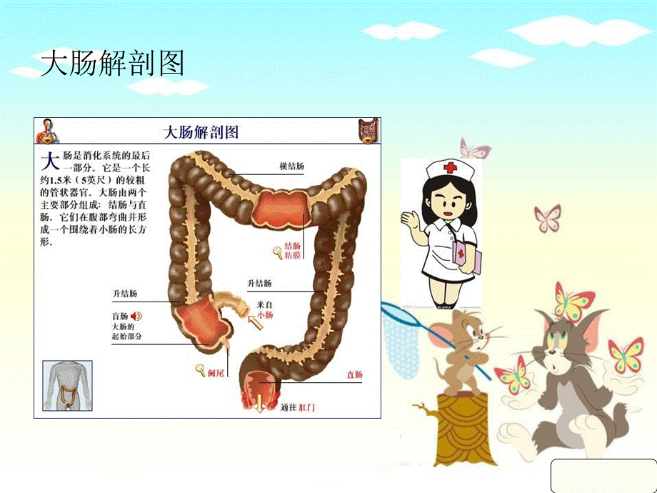 直肠癌业务学习ppt课件.ppt_第3页