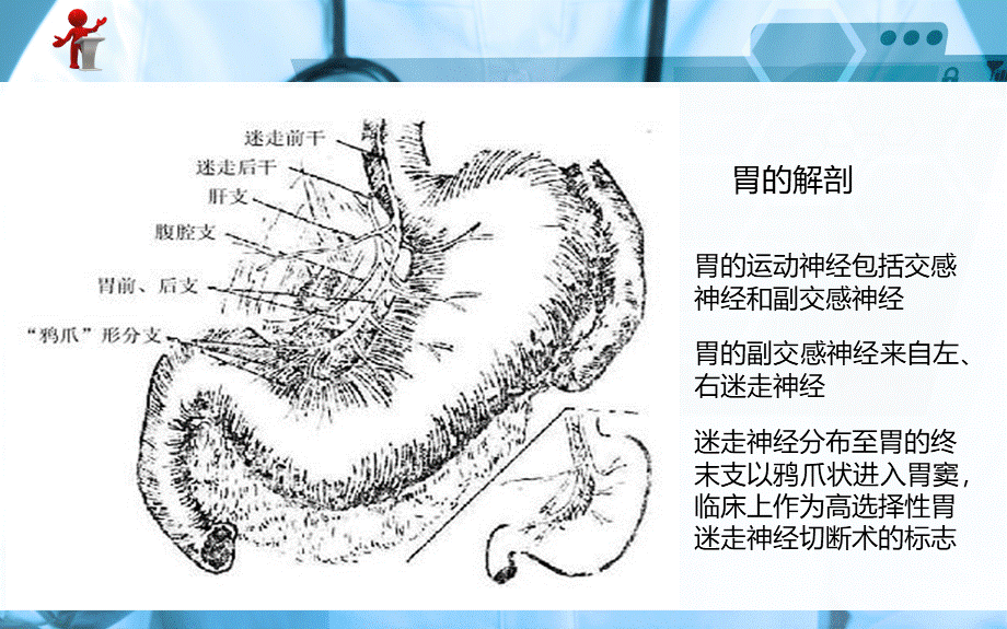 《外科护理》第十五章-第二节-胃十二指肠溃疡PPT文件格式下载.ppt_第3页