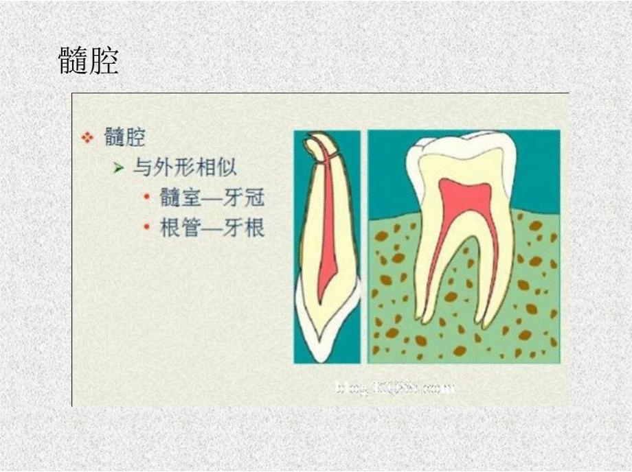 浅析根管口的探查..pptx_第3页