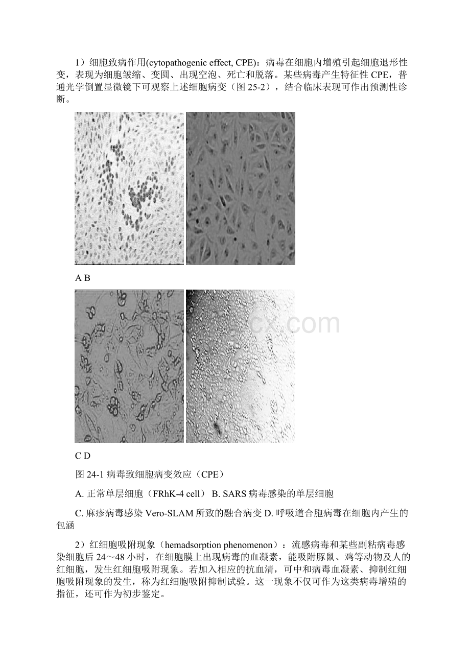 第24章病毒感染的检查方法与防治原则Word文档格式.docx_第3页