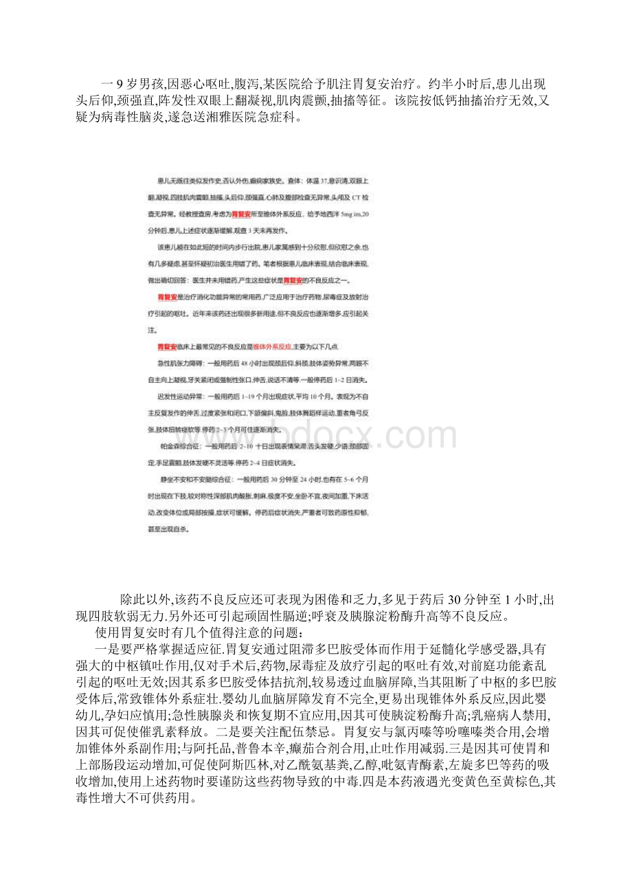 胃复安等药物引起的椎体外系反应表现及处理Word文档格式.docx_第2页