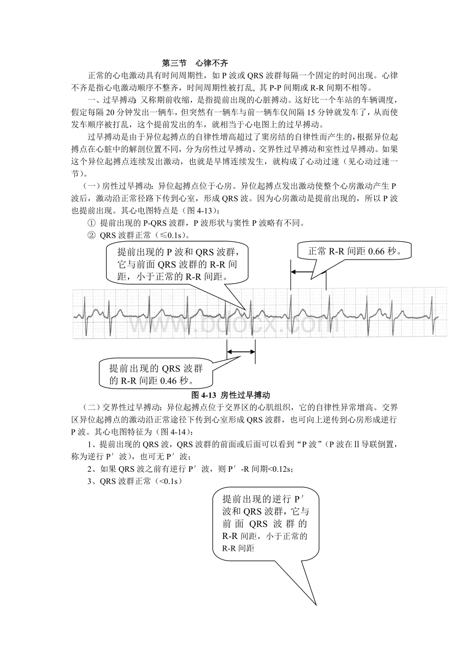 心电图超级学习法3.doc_第1页