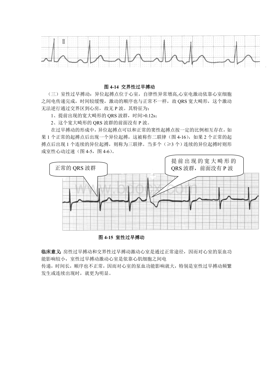 心电图超级学习法3.doc_第2页