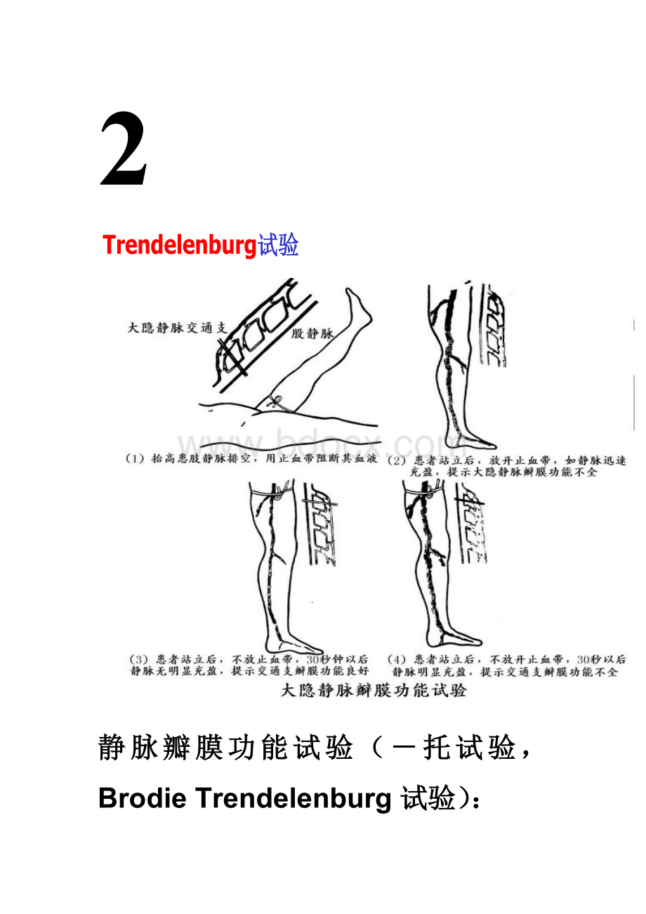 下肢静脉曲张三种检查方法.doc_第3页