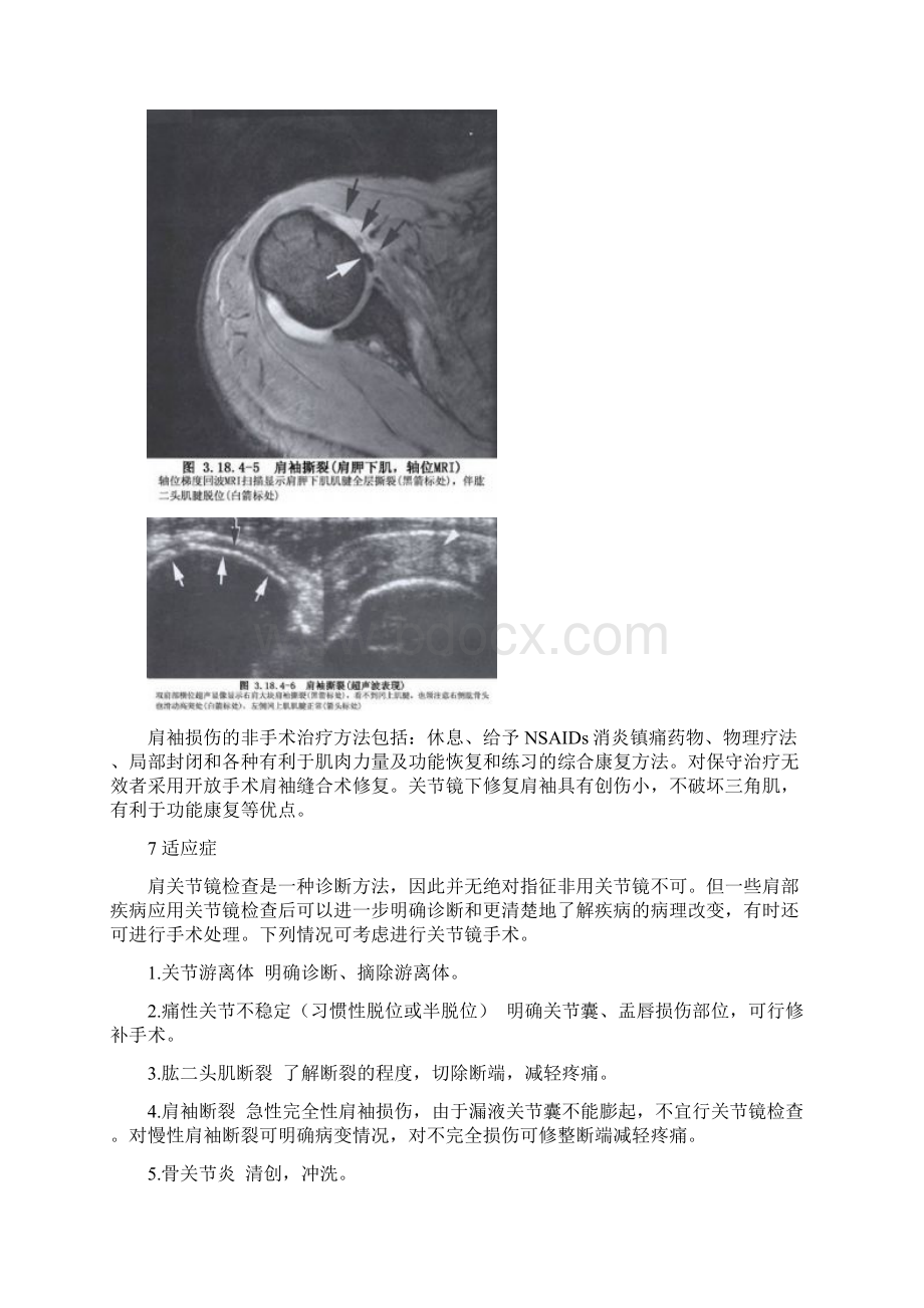 肩关节镜概述.docx_第3页