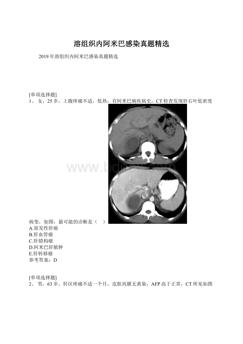 溶组织内阿米巴感染真题精选Word文档格式.docx_第1页