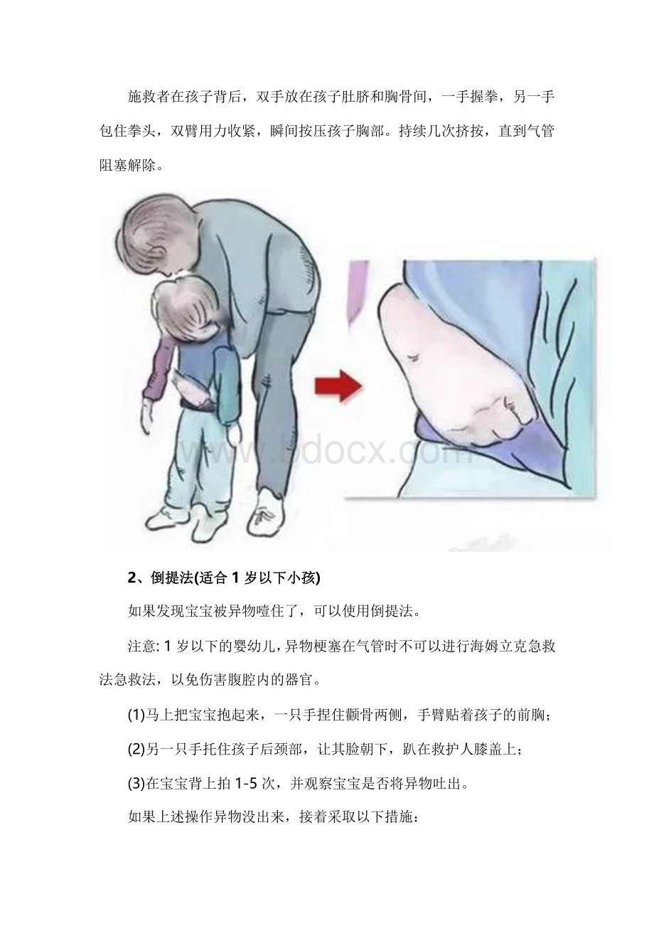 孩子特殊情况的一些急救方法.doc_第2页