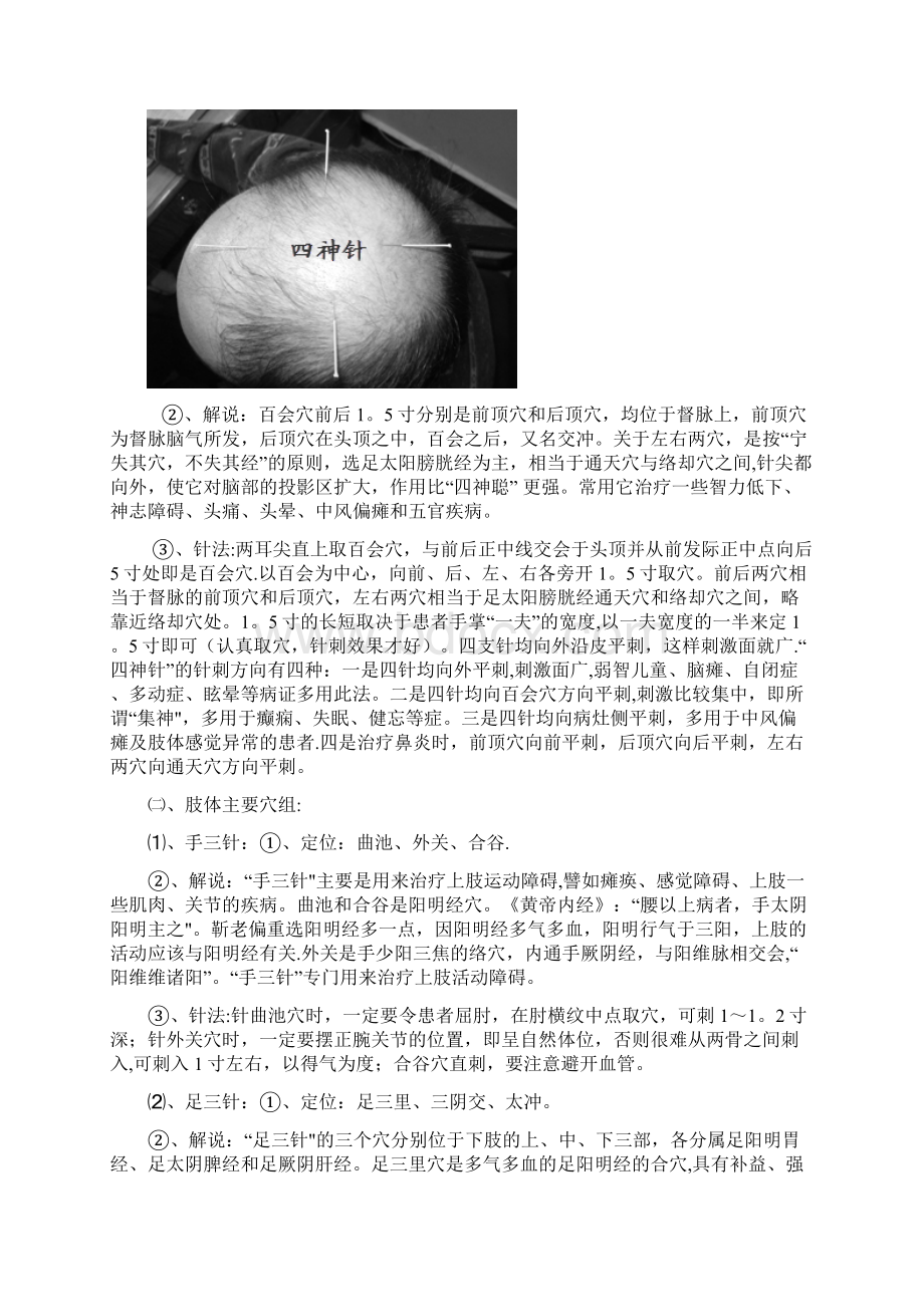 靳三针及张显臣之手三针足三针Word文档格式.docx_第3页