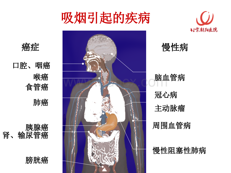 戒烟方法.ppt_第3页