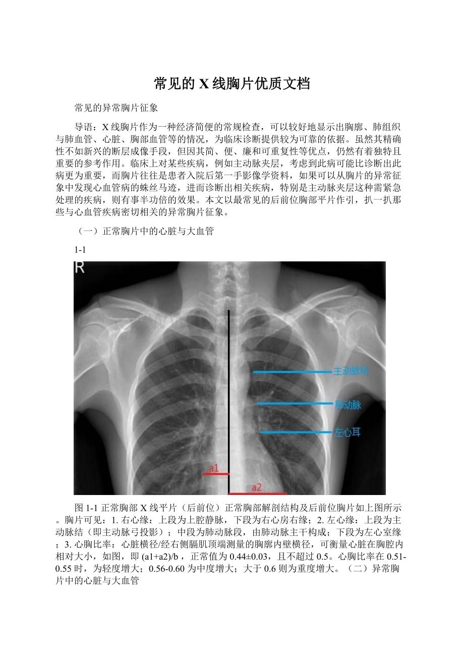 常见的X线胸片优质文档.docx