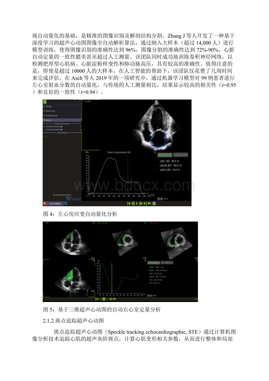 人工智能在超声心动图的应用要点Word格式.docx_第2页