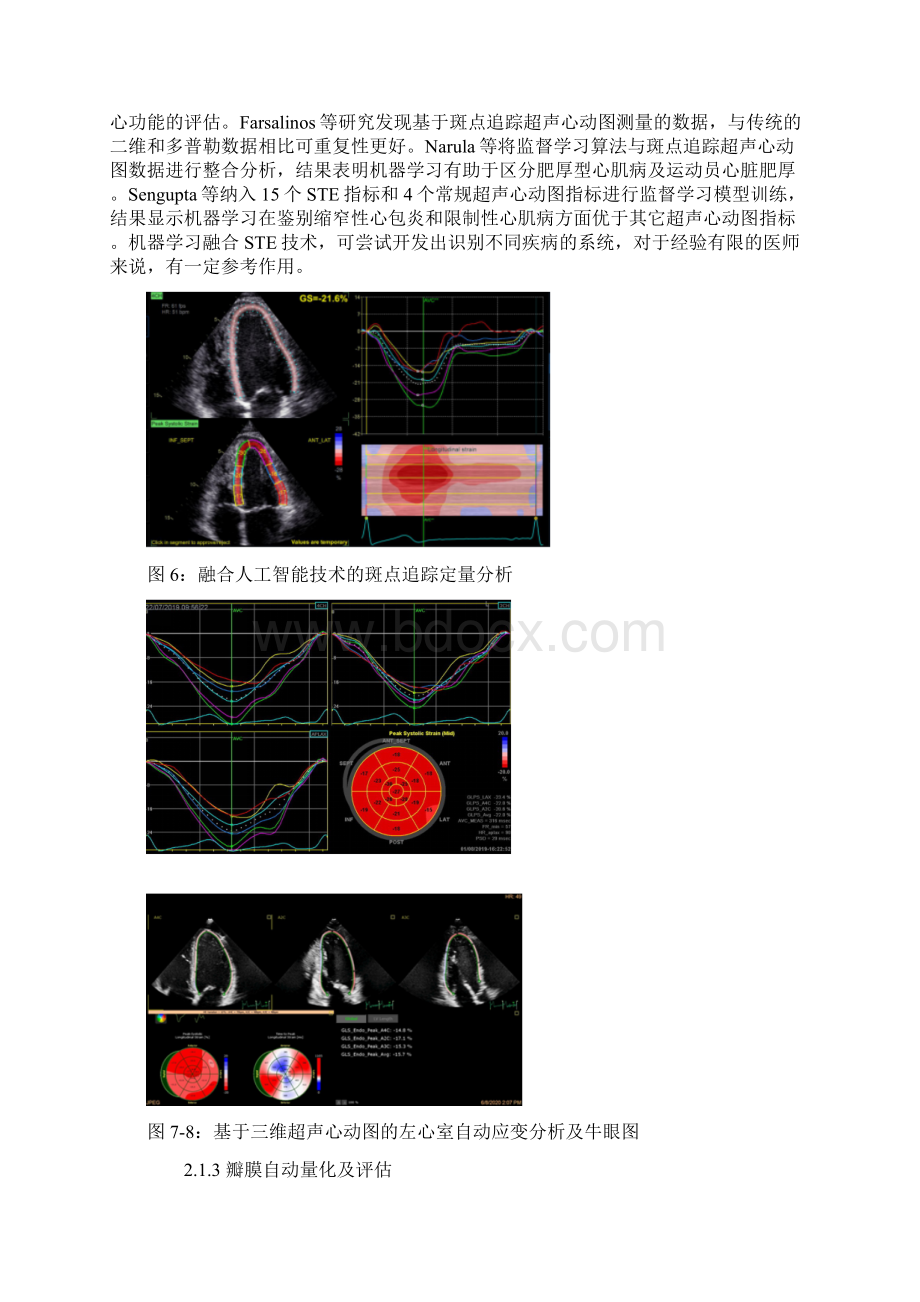 人工智能在超声心动图的应用要点Word格式.docx_第3页