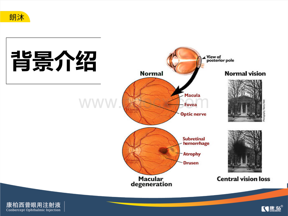 专家谈康柏西普.ppt_第2页