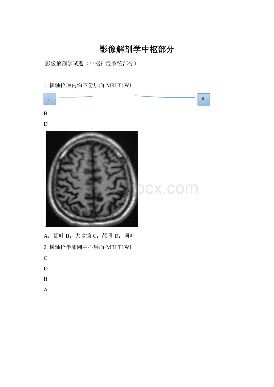 影像解剖学中枢部分文档格式.docx_第1页