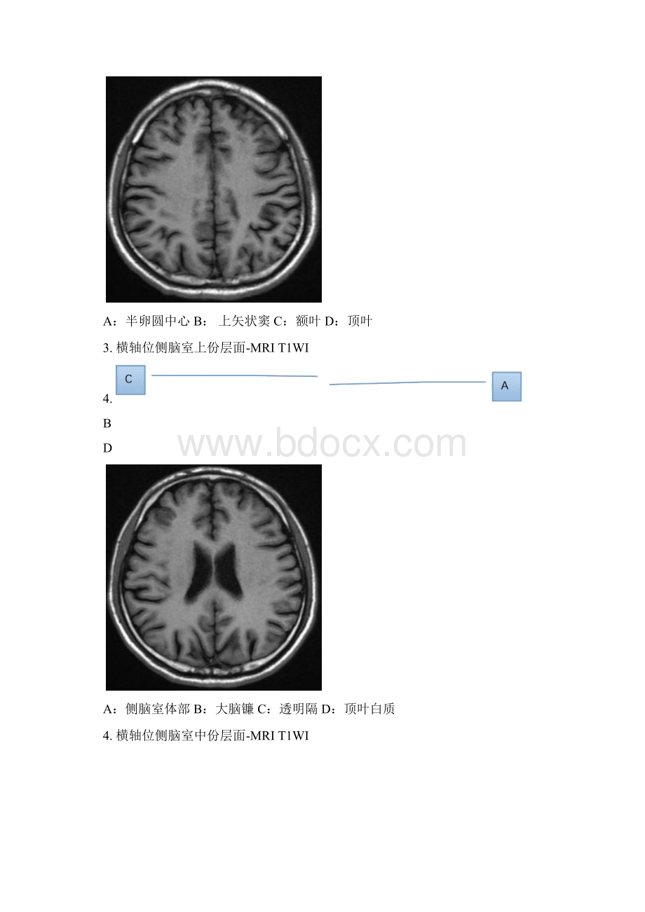 影像解剖学中枢部分文档格式.docx_第2页