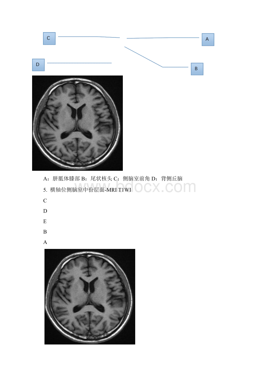 影像解剖学中枢部分文档格式.docx_第3页
