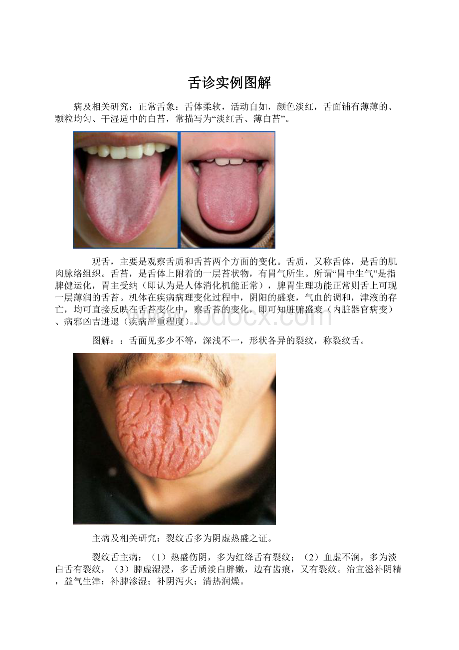 舌诊实例图解.docx