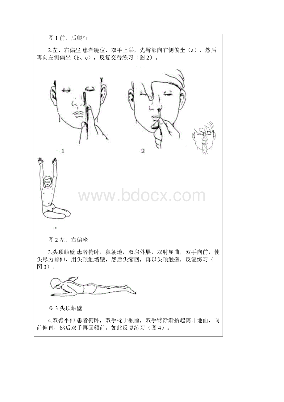 最新脊柱侧弯凸的治疗方法及矫形器支具的配置资料.docx_第2页