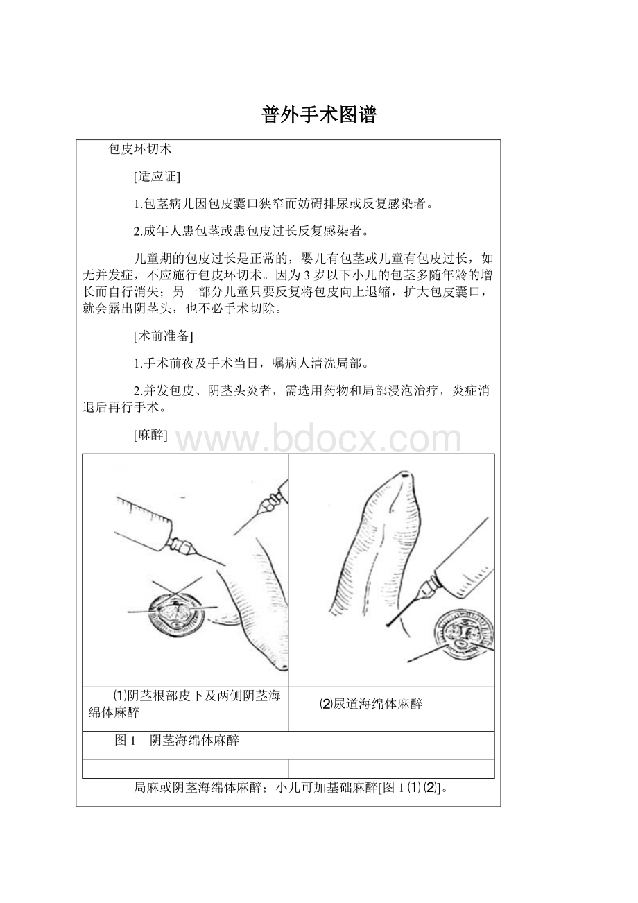 普外手术图谱Word文件下载.docx