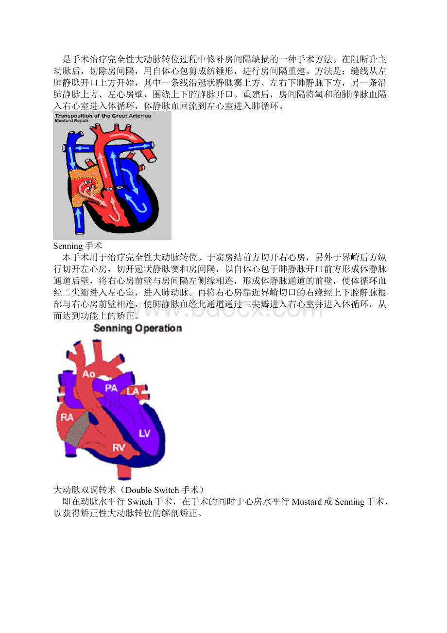 常见复杂先心病手术图解.docx_第2页