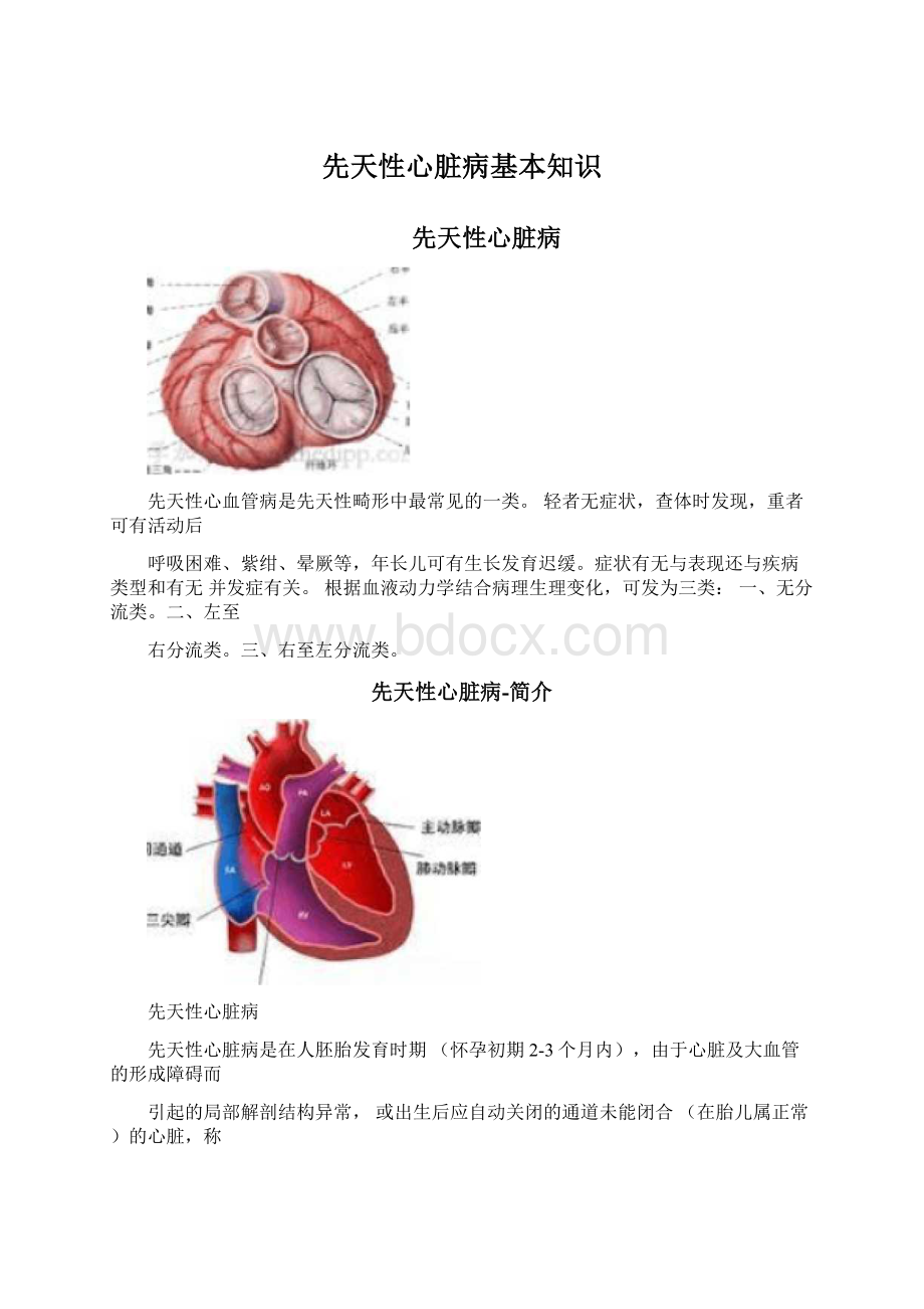 先天性心脏病基本知识.docx_第1页