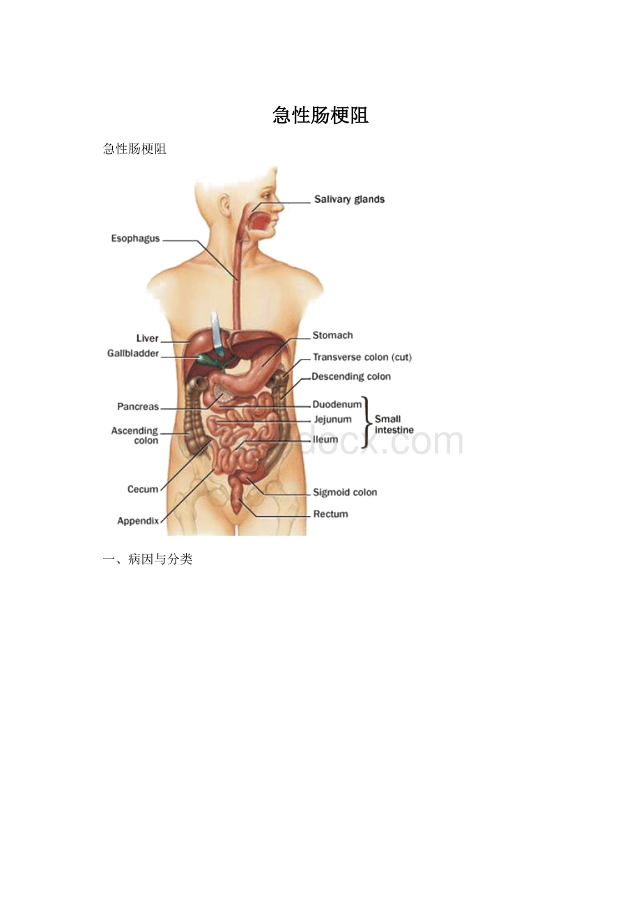 急性肠梗阻Word文档下载推荐.docx_第1页