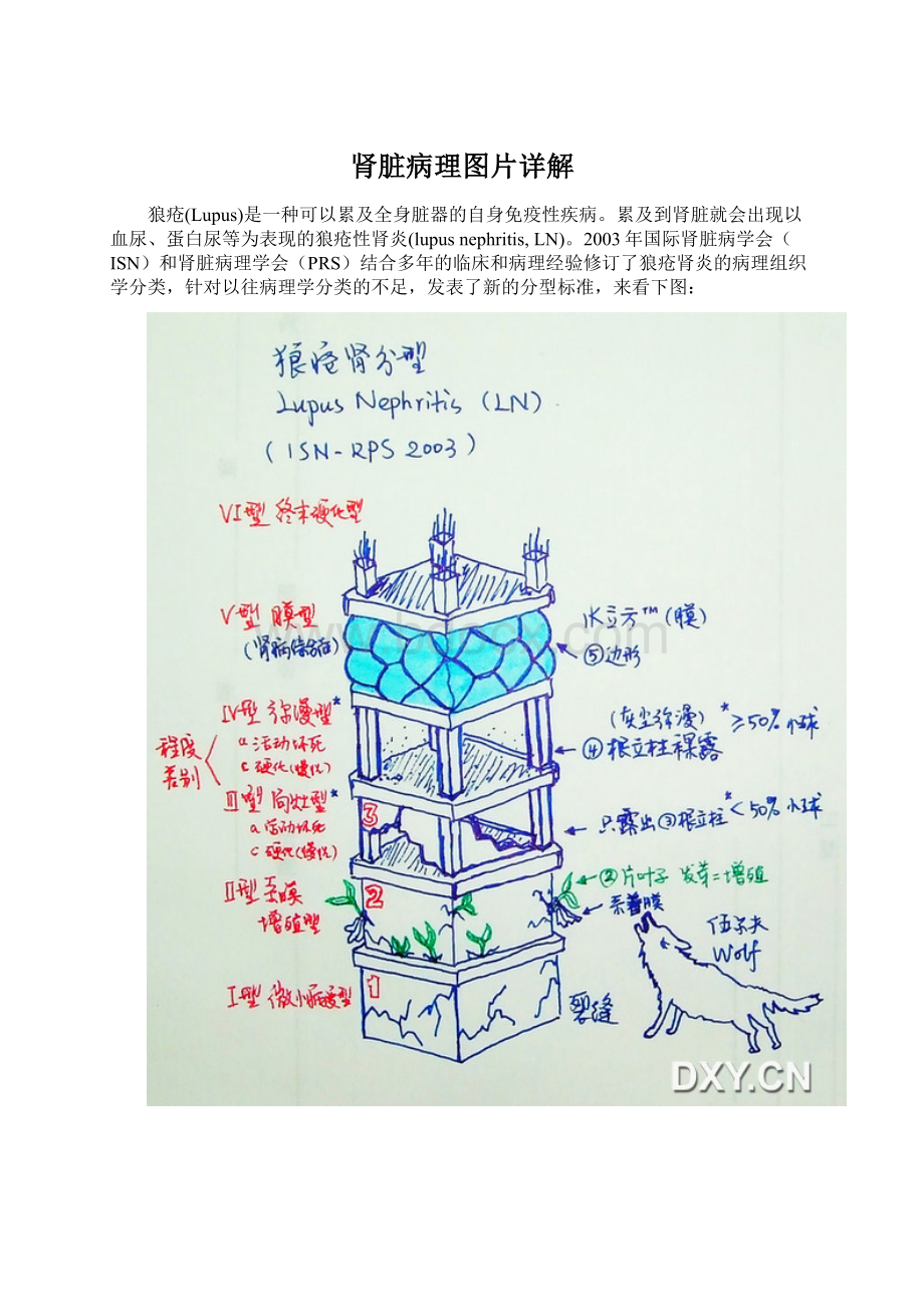 肾脏病理图片详解.docx