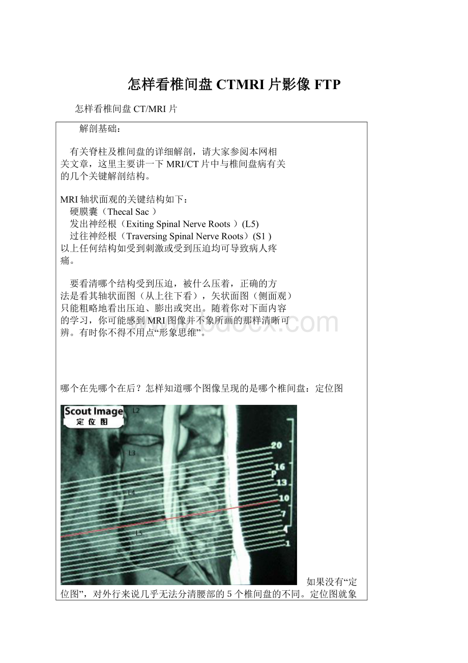 怎样看椎间盘CTMRI片影像FTP.docx_第1页