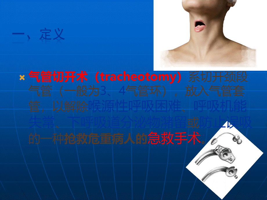 气管切开术Tracheotomyppt医学课件优质PPT.ppt_第3页