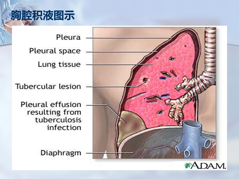 三大穿刺术胸穿腹穿腰穿复习进程PPT格式课件下载.ppt_第2页