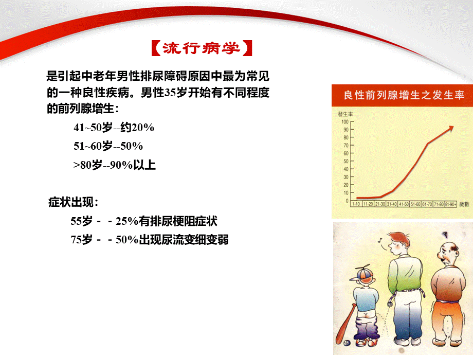 前列腺增生症.PPTPPT文件格式下载.ppt_第2页