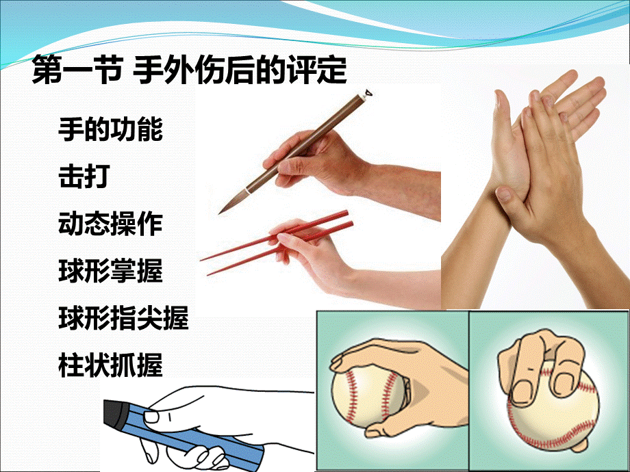 常见骨关节疾病评定.ppt_第3页