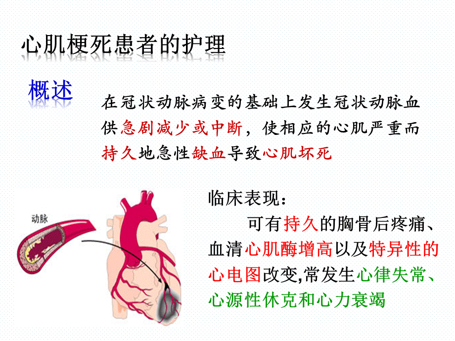 心梗治疗与护理的业务学习PPT文档格式.ppt_第2页