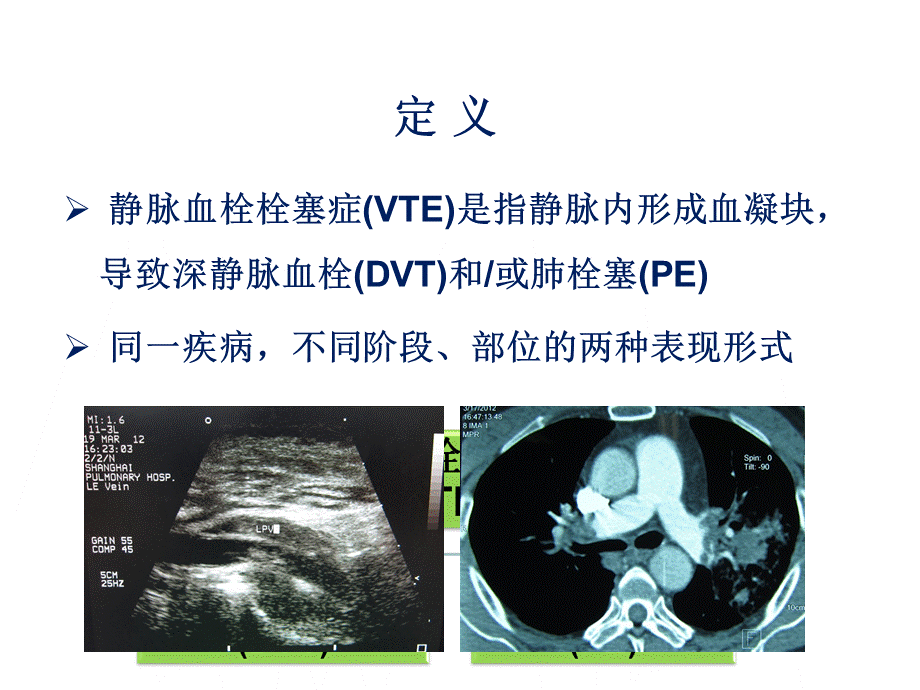 肿瘤相关性静脉血栓栓塞症的诊断与治疗PPT资料.pptPPT资料.ppt_第2页