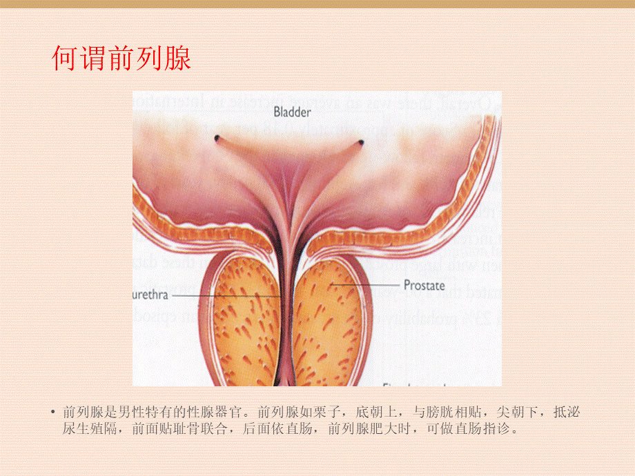 前列腺增生的围手术期护理.ppt_第3页