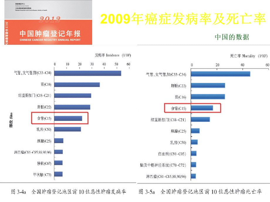 食管癌综合治疗的的思考.ppt_第3页