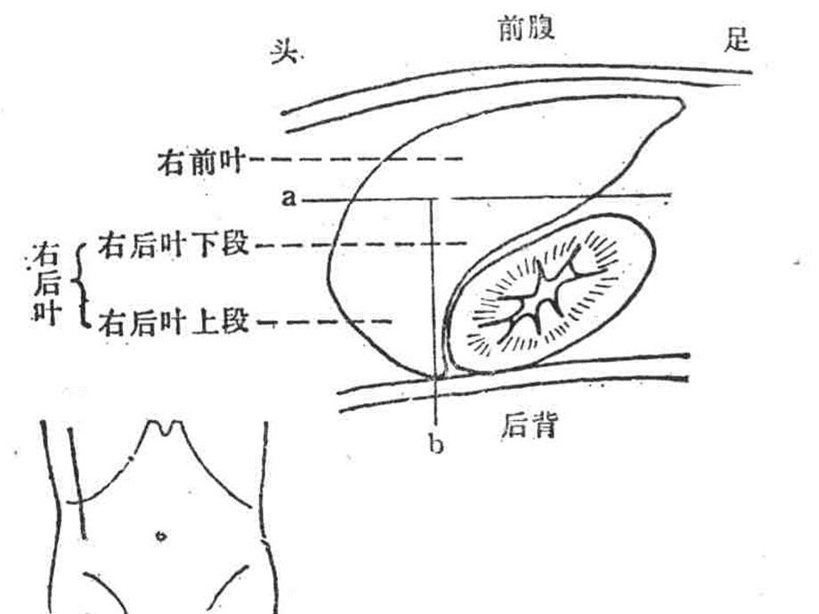 腹部超声诊断ppt课件PPT推荐.ppt_第3页