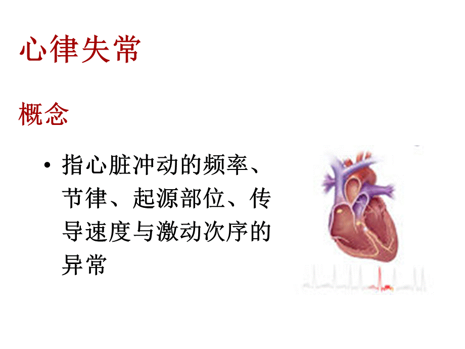 心律失常患者观察护理PPT.ppt_第2页