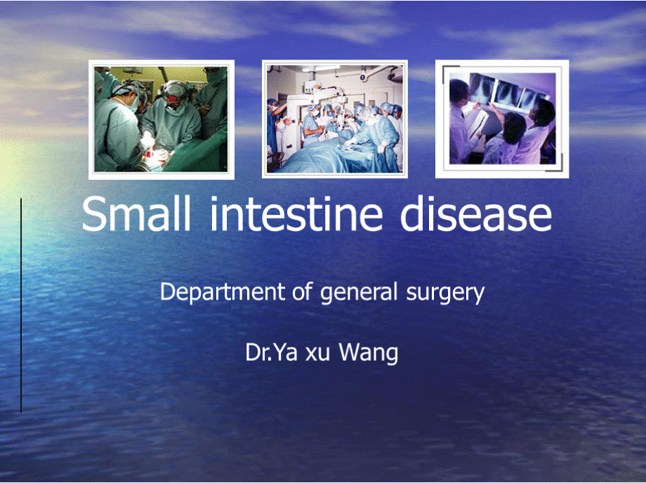 外科学课件14、Small intestine diseasePPT课件下载推荐.pptx