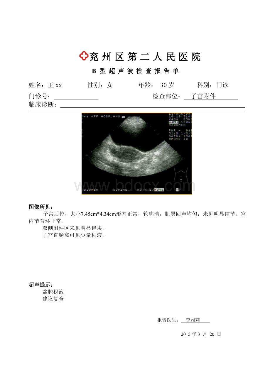 B超报告单模板.doc