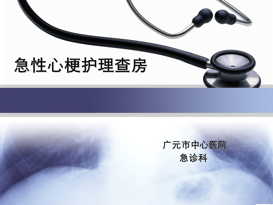 急性心肌梗死护理查房PPT文档格式.ppt_第1页