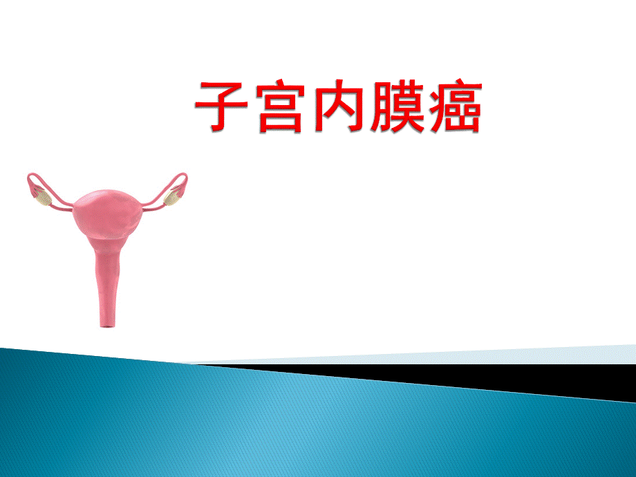 子宫内膜癌PPT格式课件下载.ppt